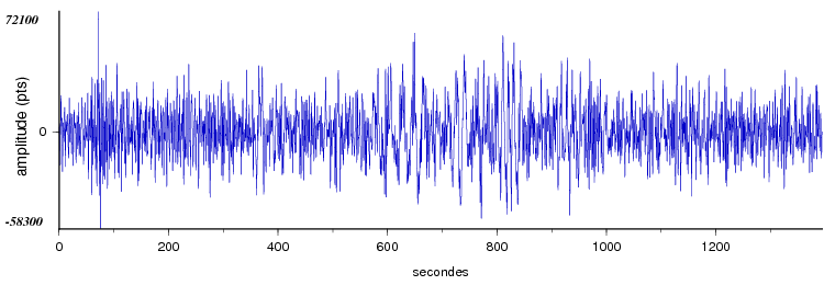 signal d'un seisme dans le monde vu par la station d'Arette
