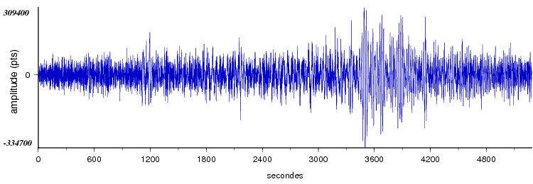 signal d'un seisme dans le monde vu par la station d'Arette