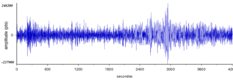 signal d'un seisme dans le monde vu par la station d'Arette